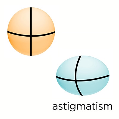 Astigmatism eye